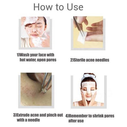 Blackhead Remover Kit
