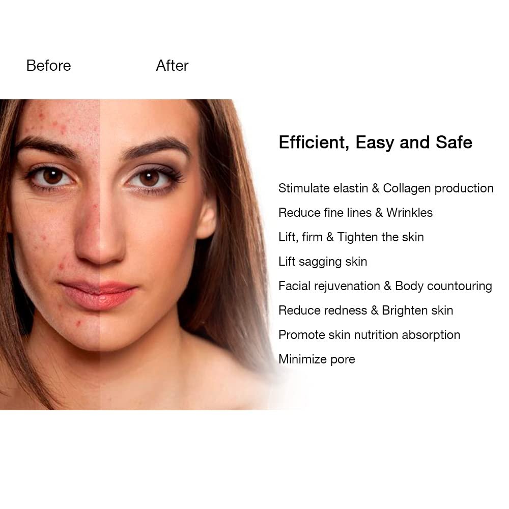 Bipolar RF Facial Beauty Device