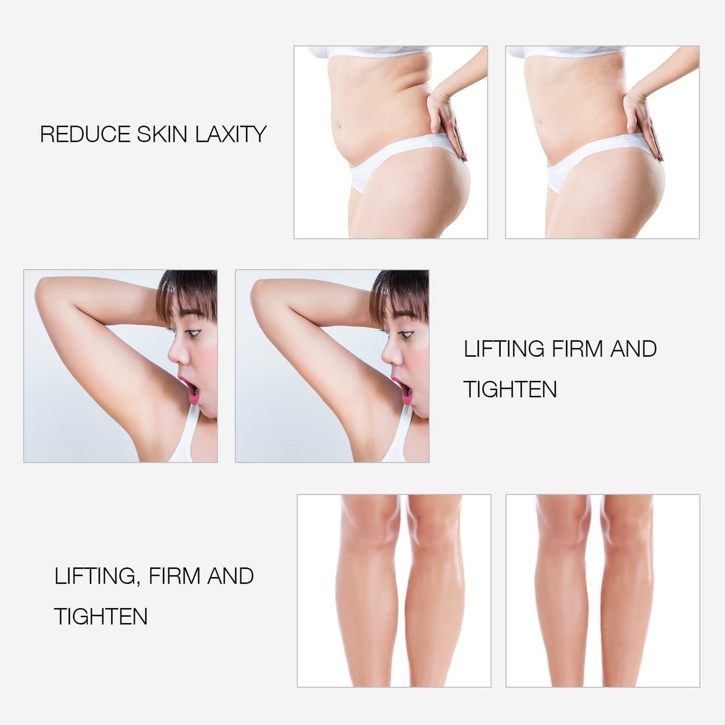 Bipolar RF Facial Beauty Device