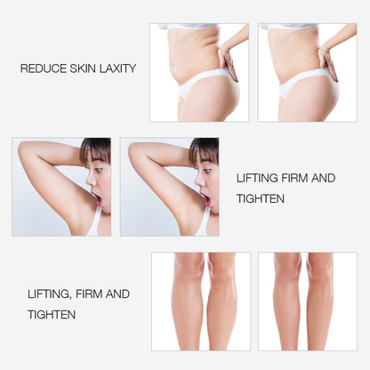 Bipolar RF Facial Beauty Device