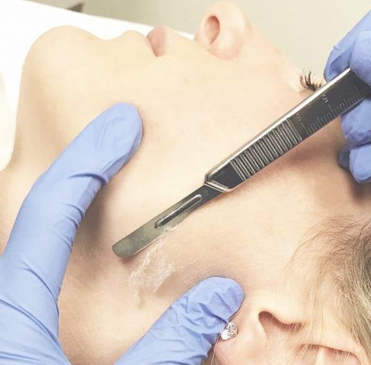 Dermaplaning