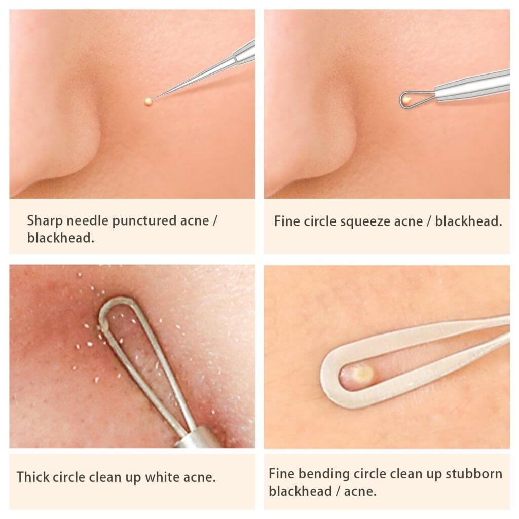 Blackhead Remover Kit